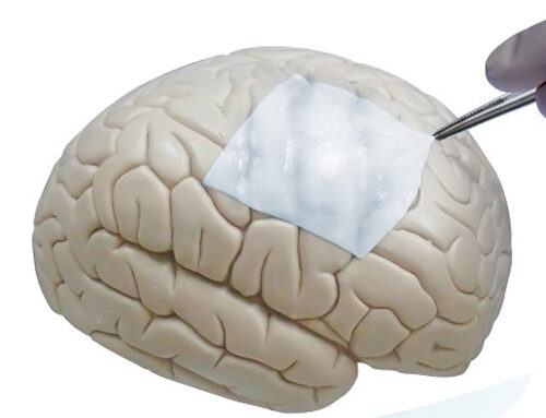 Redura™ – Substituto Dural Biomimétrico – Sintético – Absorvível